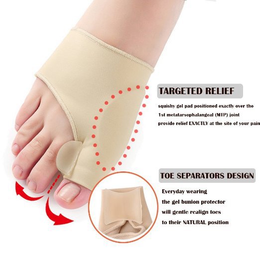 Hallux Valgus Correction Splint Bunion Corrector