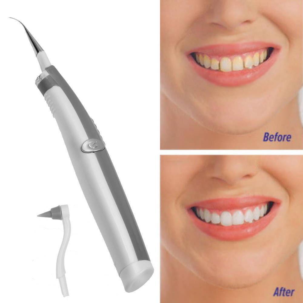 Sonic Ultrasonic Dental Teeth Whitening Cleaning Tool